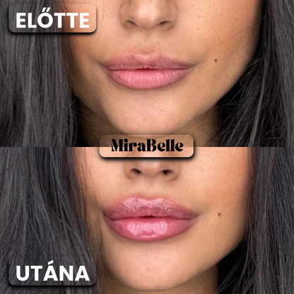 MiraBelle – BotoxLips Szájfény (Fájdalom És Csípő Érzés Nélkül Dúsítja Ajkaid)