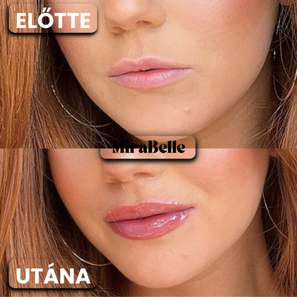 MiraBelle – BotoxLips Szájfény (Fájdalom És Csípő Érzés Nélkül Dúsítja Ajkaid)