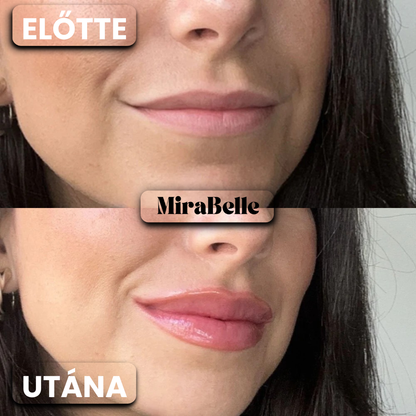 MiraBelle – BotoxLips Szájfény (Fájdalom És Csípő Érzés Nélkül Dúsítja Ajkaid)