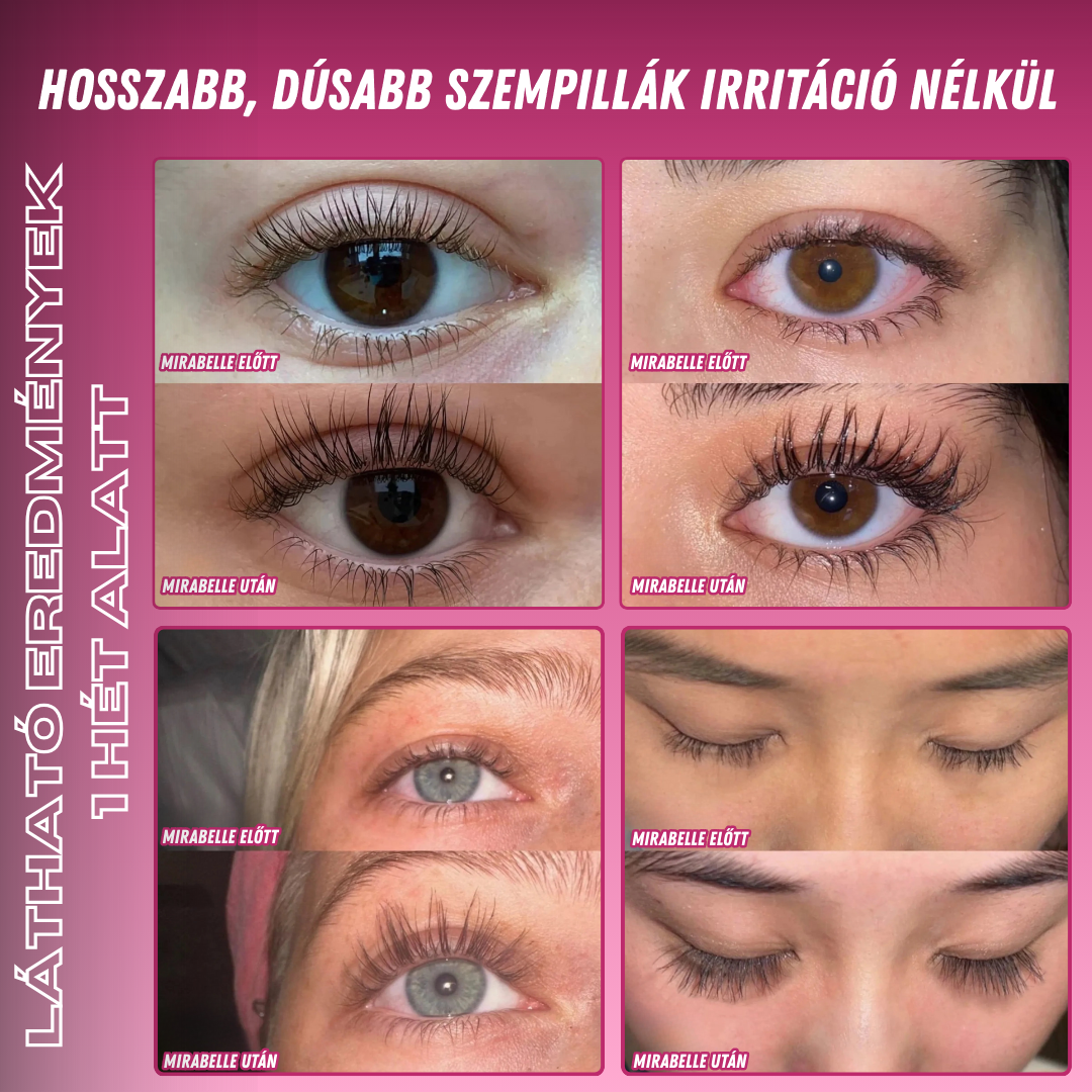 MiraBelle – Szempillanövesztő Szérum (Irritáció És Természetes Módon Növeszti A Szempillákat)